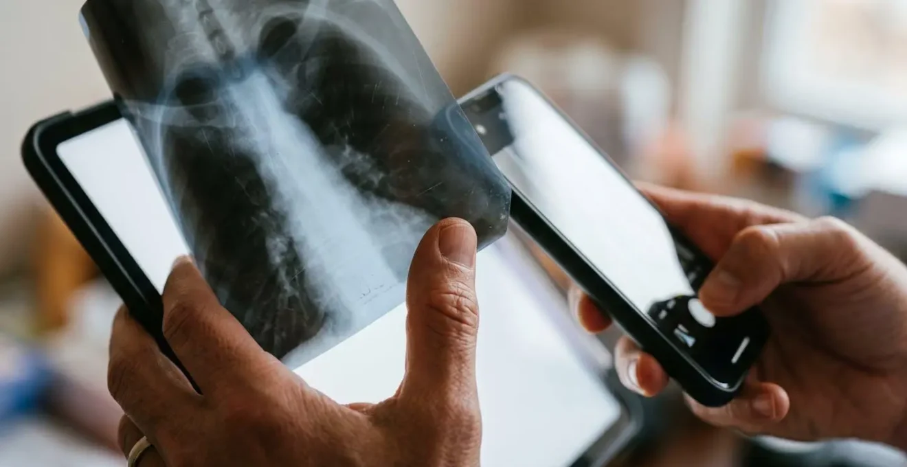 Personne photographiant une radiographie médicale rétroéclairée sur écran lumineux avec son smartphone